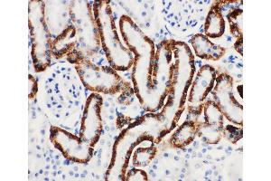 Anti-SLC22A6 antibody, IHC(P) IHC(P): Rat Kidney Tissue (SLC22A6 antibody  (C-Term))