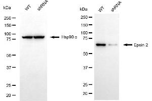 Western blotting analysis using epsin 2 antibody (ABIN7798488).