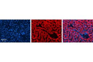 P4HB antibody - C-terminal region          Formalin Fixed Paraffin Embedded Tissue:  Human Liver Tissue    Observed Staining:  Cytoplasm in hepatocytes   Primary Antibody Concentration:  1:100    Secondary Antibody:  Donkey anti-Rabbit-Cy3    Secondary Antibody Concentration:  1:200    Magnification:  20X    Exposure Time:  0. (P4HB antibody  (C-Term))