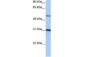 EPHX1 antibody used at 1 ug/ml to detect target protein.