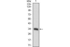 Western blot analysis using CD93 mAb against human CD93 recombinant protein.
