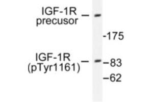 Image no. 1 for anti-Insulin-Like Growth Factor 1 Receptor (IGF1R) (pTyr1161) antibody (ABIN318045) (IGF1R antibody  (pTyr1161))