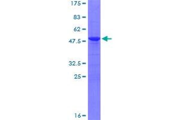 Adrenomedullin Protein (ADM) (AA 1-185) (GST tag)