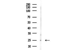 anti-Tumor Protein, Translationally-Controlled 1 (TPT1) (pSer46) antibody