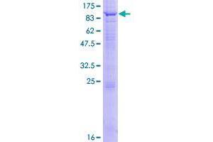 WDR16 Protein (AA 1-620) (GST tag)