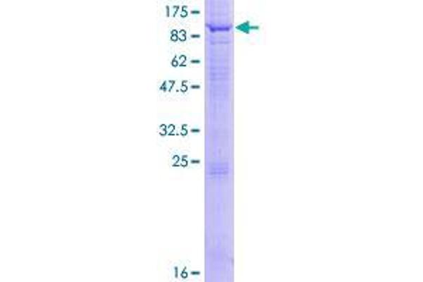 WDR16 Protein (AA 1-620) (GST tag)
