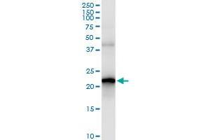 Immunoprecipitation of SELS transfected lysate using anti-SELS MaxPab rabbit polyclonal antibody and Protein A Magnetic Bead , and immunoblotted with SELS purified MaxPab mouse polyclonal antibody (B02P) . (Selenoprotein S antibody  (AA 1-187))