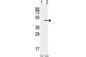 Western Blotting (WB) image for anti-SET Domain Containing 8 Pseudogene 1 (SETD8P1) antibody (ABIN2996451)
