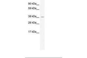 Image no. 1 for anti-Heat Shock Transcription Factor, Y Linked 2 (HSFY2) (C-Term) antibody (ABIN202414) (HSFY2 antibody  (C-Term))