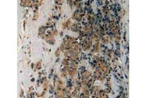 Figure. (LPCAT3 antibody  (AA 122-233))