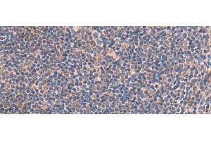 Immunohistochemistry of paraffin-embedded Human tonsil tissue using IP6K2 Polyclonal Antibody at dilution of 1:45(x200) (IP6K2 antibody)