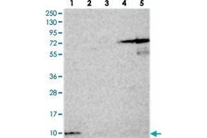 Western blot analysis of Lane 1: RT-4, Lane 2: U-251 MG, Lane 3: Human Plasma, Lane 4: Liver, Lane 5: Tonsil with HIGD1A polyclonal antibody  at 1:250-1:500 dilution.