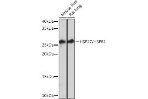 Western blot analysis of extracts of various cell lines, using HSP27/HSPB1Rabbit mAb (ABIN7267569) at 1:1000 dilution. (HSP27 antibody)