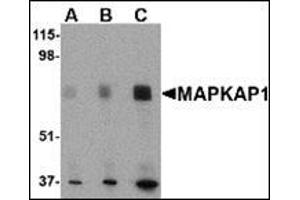 Western blot analysis of MAPKAP1 in human skeletal muscle tissue lysate with this product at (A) 0. (Transportin 1 antibody  (N-Term))
