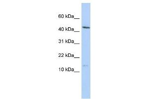 MYL6 antibody used at 1 ug/ml to detect target protein.