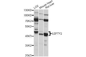 Western blot analysis of extracts of various cell lines, using LEFTY2 antibody (ABIN6292173) at 1:1000 dilution.