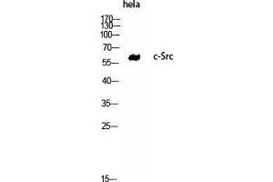 Western Blot (WB) analysis of HeLa using c-Src Polyclonal Antibody. (Src antibody  (Tyr1172))