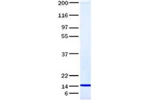 Validation with Western Blot (IL-22 Protein)