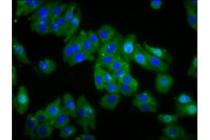 Immunofluorescence staining of HepG2 cells with ABIN7159174 at 1:66, counter-stained with DAPI. (OPN1MW antibody  (AA 1-52))