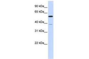 anti-Protein Phosphatase 2, Regulatory Subunit B' alpha (PPP2R5A) (AA 107-156) antibody