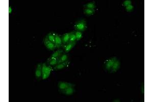 Immunofluorescence staining of HepG2 cells with ABIN7168317 at 1:120, counter-stained with DAPI. (RBMS1 antibody  (AA 206-277))