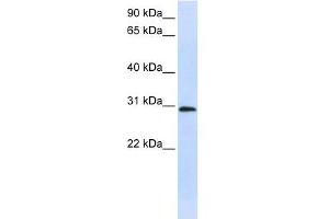 C6ORF21 antibody used at 1 ug/ml to detect target protein.