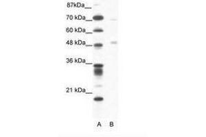 Image no. 1 for anti-Pancreatic Lipase (PNLIP) (AA 364-413) antibody (ABIN202588) (PNLIP antibody  (AA 364-413))