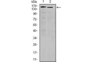 Western Blotting (WB) image for anti-Integrin alpha 4 (ITGA4) antibody (ABIN1106427) (ITGA4 antibody)