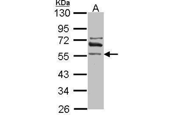 ALDH1A2 抗体