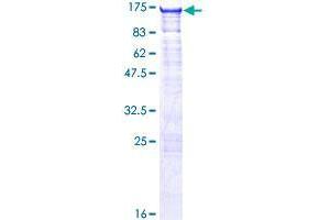 Image no. 1 for Solute Carrier Family 4 (Anion Exchanger), Member 1, Adaptor Protein (SLC4A1AP) (AA 1-796) protein (GST tag) (ABIN1320470) (NADAP Protein (AA 1-796) (GST tag))