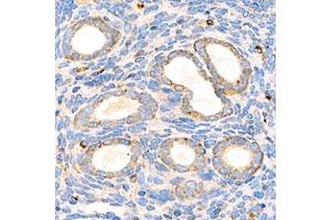 Immunohistochemistry analysis of paraffin-embedded mouse uterus using,Arp2 (ABIN7072895) at dilution of 1: 1500 (ARPC1B antibody)