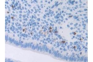 Immunohistochemistry (IHC) image for anti-Activating Transcription Factor 6 (ATF6) (AA 1-377) antibody (ABIN7440587)
