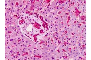 Human Liver: Formalin-Fixed, Paraffin-Embedded (FFPE) (SMO antibody  (N-Term))