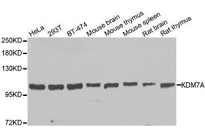 Western blot analysis of extracts of various cell lines, using KDM7A antibody. (JHDM1D antibody  (AA 417-735))