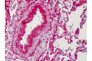 Anti-Elastin antibody IHC of human lung. (Elastin antibody)