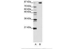 Image no. 2 for anti-Pre-mRNA Branch Site Protein p14 (SF3B14) (AA 90-139) antibody (ABIN203256) (Pre-mRNA Branch Site Protein p14 (SF3B14) (AA 90-139) antibody)