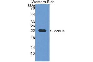 Western Blotting (WB) image for anti-Prepronociceptin (PNOC) (AA 20-176) antibody (ABIN1176128) (PNOC antibody  (AA 20-176))