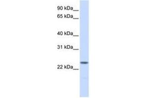 Image no. 1 for anti-Nucleophosmin/nucleoplasmin 2 (NPM2) (AA 36-85) antibody (ABIN6741439) (NPM2 antibody  (AA 36-85))