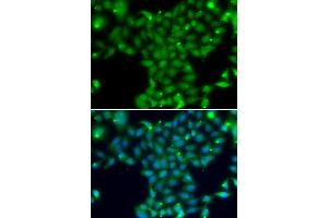 Immunofluorescence analysis of U20S cell using TGM5 antibody. (Transglutaminase 5 antibody)