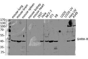 Western Blot (WB) analysis of specific lysis using GHRH-R Polyclonal Antibody. (GHRHR antibody  (C-Term))