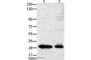 Western blot analysis of 231 cell and mouse testis tissue, using GNRHR Polyclonal Antibody at dilution of 1:2350 (GNRHR antibody)