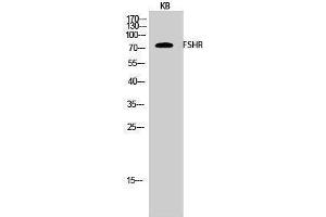 Western Blotting (WB) image for anti-Follicle Stimulating Hormone Receptor (FSHR) (Internal Region) antibody (ABIN3175168) (FSHR antibody  (Internal Region))