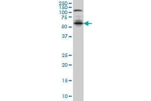IRF5 monoclonal antibody (M04), clone 3C2 Western Blot analysis of IRF5 expression in A-431 . (IRF5 antibody  (AA 395-504))
