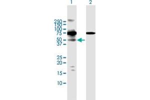 Western Blot analysis of RIOK3 expression in transfected 293T cell line by RIOK3 MaxPab polyclonal antibody. (RIOK3 antibody  (AA 1-519))