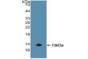 Detection of Recombinant GbA, Human using Polyclonal Antibody to Glucocerebrosidase (GBA) (GBA antibody  (AA 117-214))