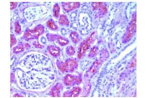 Immunohistochemical analysis of Human L-FABP in Paraffin Embedded Human kidney tissue using FABP1 Antibody Cat. (FABP1 antibody)