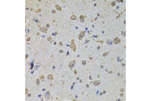 Immunohistochemistry of paraffin-embedded mouse brain using EIF4A2 antibody (ABIN5972034) at dilution of 1/100 (40x lens). (EIF4A2 antibody)