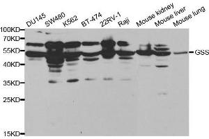 Western blot analysis of extracts of various cell lines, using GSS antibody. (Glutathione Synthetase antibody  (AA 1-474))