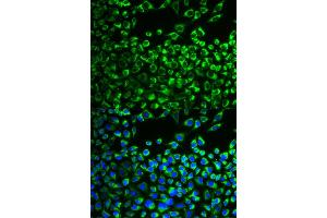 Immunofluorescence analysis of MCF-7 cells using CYP51A1 antibody (ABIN6292369). (CYP51A1 antibody)