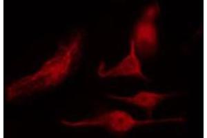 ABIN6268988 staining NIH-3T3 by IF/ICC. (HNRNPK antibody  (pSer284))